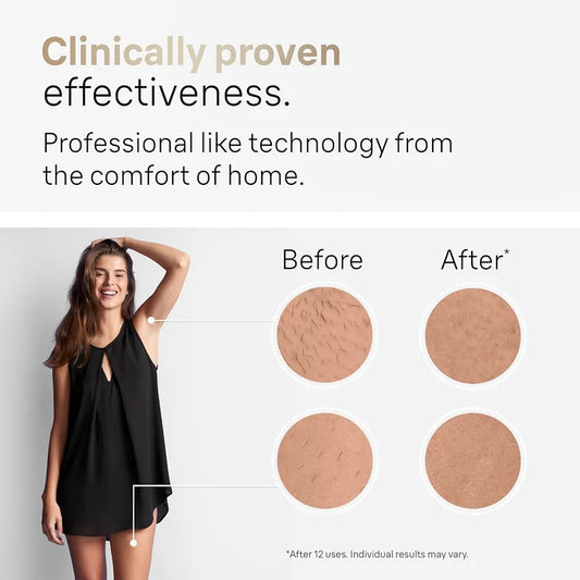 جهاز إزالة الشعر بالليزر IPL الدائم - جهاز كهربائي للوجه والجسم للنساء والرجال